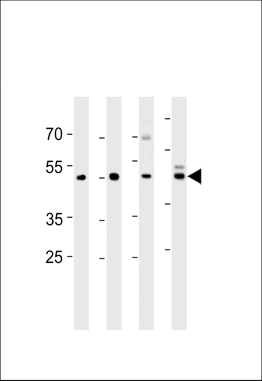 WB - ENOA Antibody (N-term) AP2879a